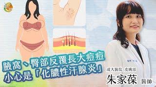 【化膿性汗腺炎】朱家葆醫師-成大e學堂