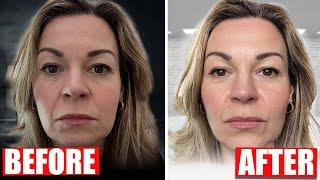 Influencers' anti-aging secret! See how lighting transforms skin and teeth