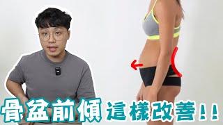 骨盆前傾害你腰痛難久站！？你該這樣改善！