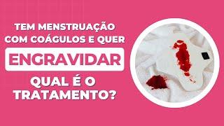 Tem menstruação com coágulos e quer engravidar: saiba qual o tratamento