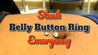 A Stuck Belly Button Ring Emergency