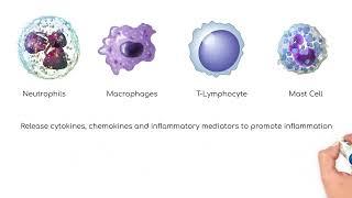 Pathophysiology: Chronic Obstructive Pulmonary Disease (COPD)