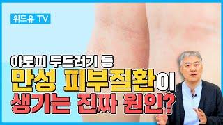 만성피부질환을 일으키는 3가지 요인은? 과정을 알아야 치료를 할 수 있습니다.