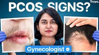 OBGYN Debunks 14 Popular PCOS & PCOD Myths!