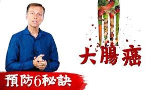 預防大腸癌6個秘訣,柏格醫生 Dr Berg