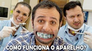 Como o aparelho desentorta os dentes? #Boravê