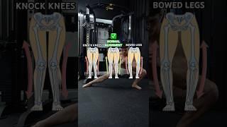 Stabilize your knee and correct movement patterns over time #kneepain #workout #healthy
