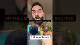 This is the Hair Loss routine that Saved my Hair!