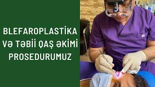 Blefaroplastika və Təbii qaş əkimi prosedurlarımız 