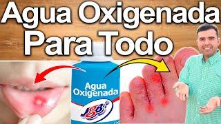 Agua Oxigenada Para Todo - Cómo Usarla? - Para Qué Sirve? - Beneficios Para Tu Salud Y Belleza