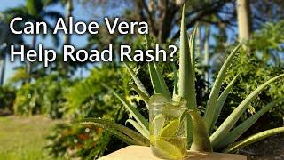 Can Aloe Vera Help Heal Road Rash? - How to treat road rash - Haley Nutrition