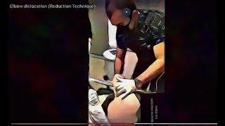 Elbow dislocation (Reduction Technique)