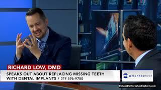 Replacing Missing Teeth with Dental Implants with Indianapolis, IN Dentist, Richard Low, DMD