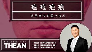 疤痕治疗 | Dr. Kenneth Thean