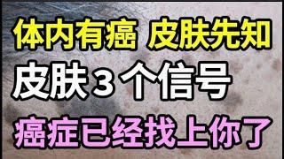 体内有癌，皮肤现在！癌症找上你的前一个月，皮肤会出现3种情况，别等癌症晚期才后悔没早嗲知道！【家庭大医生】