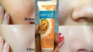 How to Use Face Scrubs | Everyuth Scrub|How to Apply Face Scrub at Home Hindi |