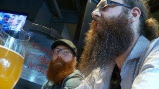 Beard transplants