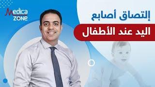 التصاق اصابع اليد عند الاطفال مع دكتور محمد فتحي | Medicazone