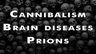 Prions and the disease of the dead.