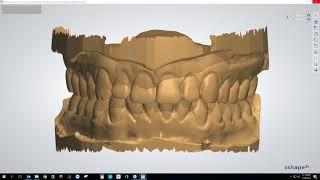[Webinar] Making Clear Aligners Using the 3Shape Ortho System Module with Brandon Smith, CDT