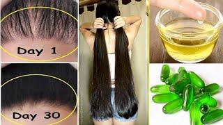 Benefits Of Vitamin E For Hair @beautyandhealthhub123