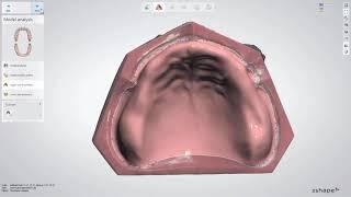 3DBioCAD - 3Shape Dental System Full Denture Design