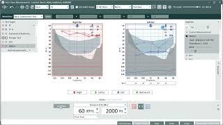 Weber Test in Auditdata Measure