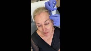 Cosmetic Injectables Demonstration