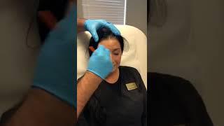Dysport Injection to Fix the "11's" Live by Dr. G @ CAMI