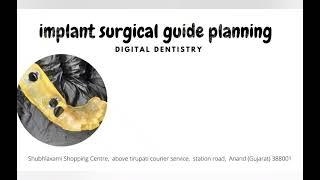 Implant Surgical Guide Planning | Digital Dentistry | DIOnavi Implant