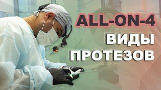 Виды протезов ALL ON 4. Какой выбрать? Бекоев Ацамаз