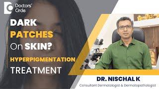 Chemical Peels For Hyperpigmentation| Peels at Home For Dark Patches -Dr.Nischal K | Doctors' Circle
