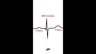 The Cardiac Cycle (P-QRS-T)