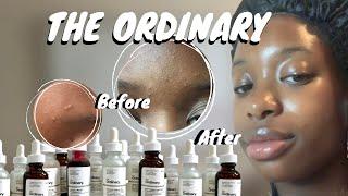 THE ORDINARY: REVIEW OF 15+ PRODUCTS