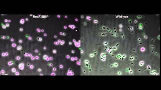 Movie S2 -  RebA S88P and WT R bodies in spheroplasts