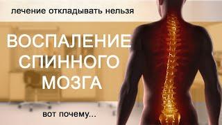 Воспаление спинного мозга