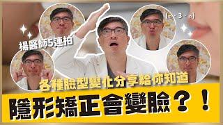 隱適美矯正讓臉型會變化？隱形牙套可以怎麼做？｜【祐民牙醫－隱適美旗艦店】鑽石級楊大為醫師 #隱適美 #臉型變化 #矯正牙齒 ＃嘴凸 ＃牙齒凸 ＃暴牙 ＃小下巴 ＃月亮臉