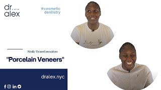 Smile Transformation -Porcelain Veneers - Dr. Alex Rubinov - Cosmetic Dentist in NYC