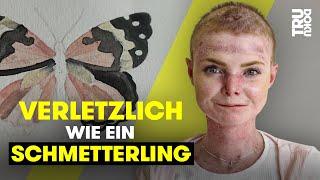 “Ich bin mehr als meine Krankheit!” - Julia (24) kämpft für ihre Träume | TRU DOKU