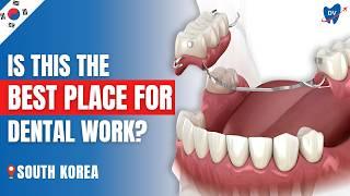 Partial Dentures in South Korea: Why This US Patient Rates Them 10/10!