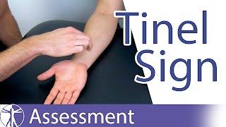 Tinel Sign: Wrist | Carpal Tunnel Syndrome Diagnosis