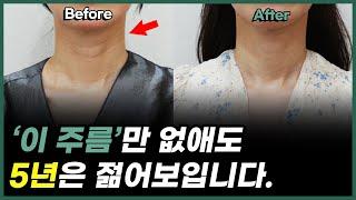 20대에 생기면 5년 늙어보이는 목주름 사라지는 3가지 방법