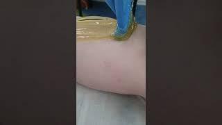 Шугаринг ног. Обучение шугарингу.