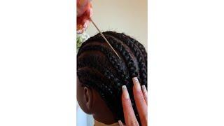ASMR Scratching your ITCHY braids  Scalp Oiling For Scalp Relief #shorts