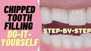 How to Fix a Chipped Tooth Filling Do-It-Yourself Dental Filling for Broken Teeth Emergency Kit