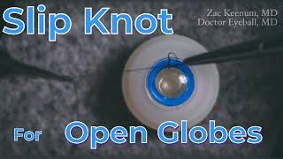 Slip Knot Technique for Open Globe Repair | Ophthalmology | Narrated by Young Surgeon