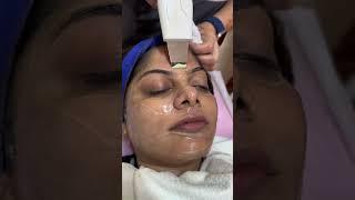 Hydra facial കൊണ്ട് ഇത്രേം മാറ്റം ഉണ്ടാകുമെന്ന് വിജാരിച്ചില്ല #fousiyaunais #reels #hydrafacial