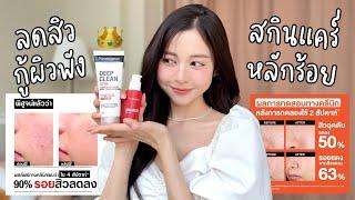  รีวิวสกินแคร์ลดสิว ตัวช่วยกอบกู้ผิวในราคาหลักร้อย Clinical test DC + Clinical test AA | Babyjingko