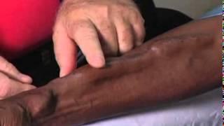 Fistula First   Healthcare Professionals   Where do I start if I am a dialysis center    Cannulation of the AV Fistula   Cannulation Video Chapter 4