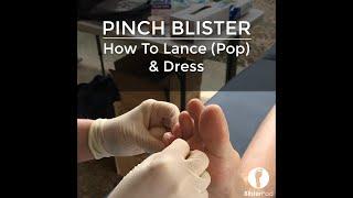 Pinky Toe Pinch Blister: How To Lance, Clean & Dress